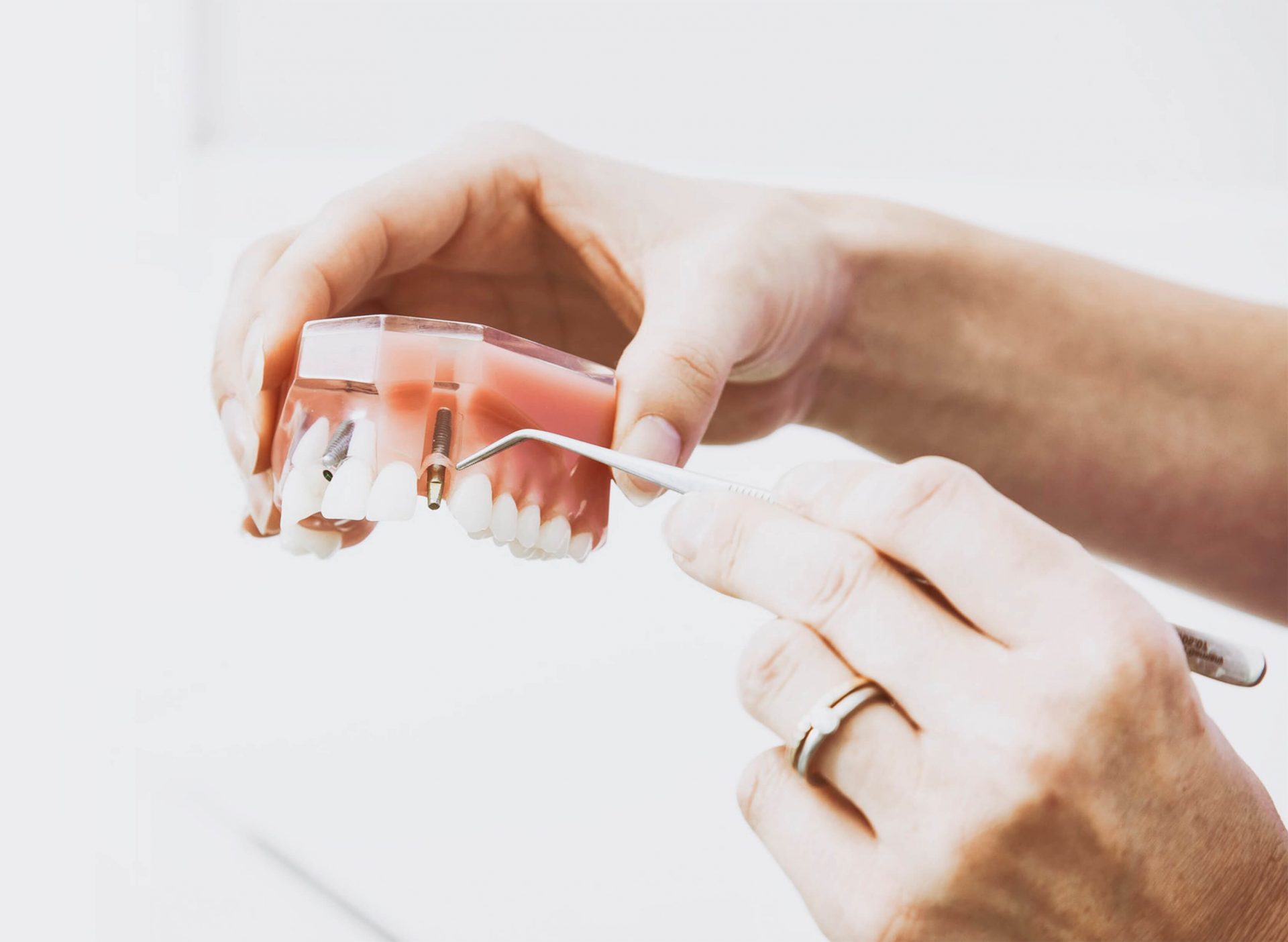 WIN Dental Care Dentistry in Edmonds and Seattle Washington.